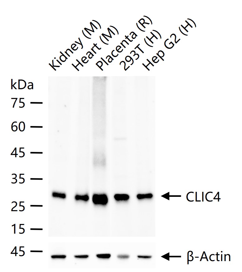 细胞内氯离子通道蛋白4重组兔单抗