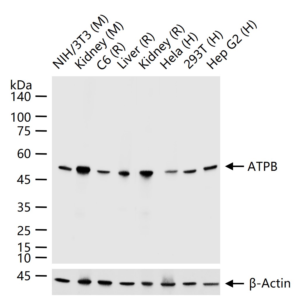 ATP合成酶β5重组兔单克隆抗体