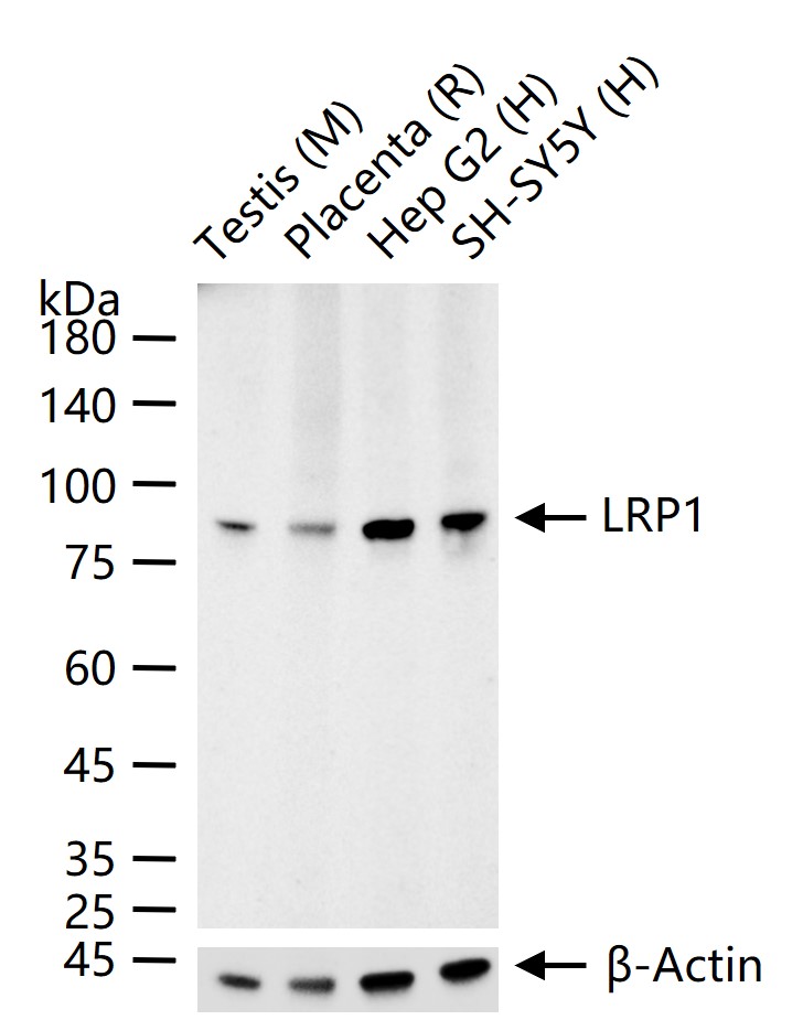 低密度脂蛋白受体相关蛋白1重组兔单抗