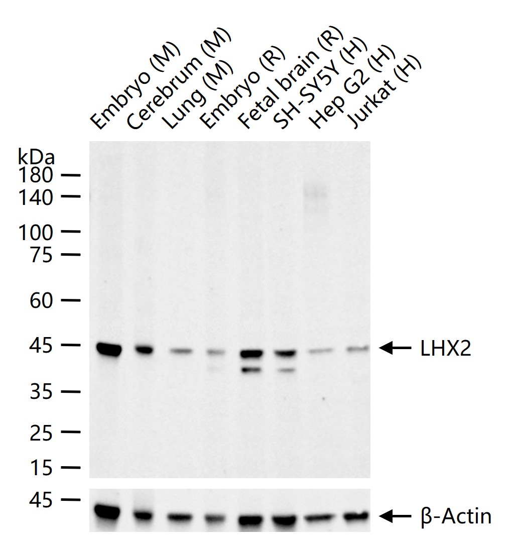 LHX2 Recombinant Rabbit mAb (一抗) - WB | Bioss
