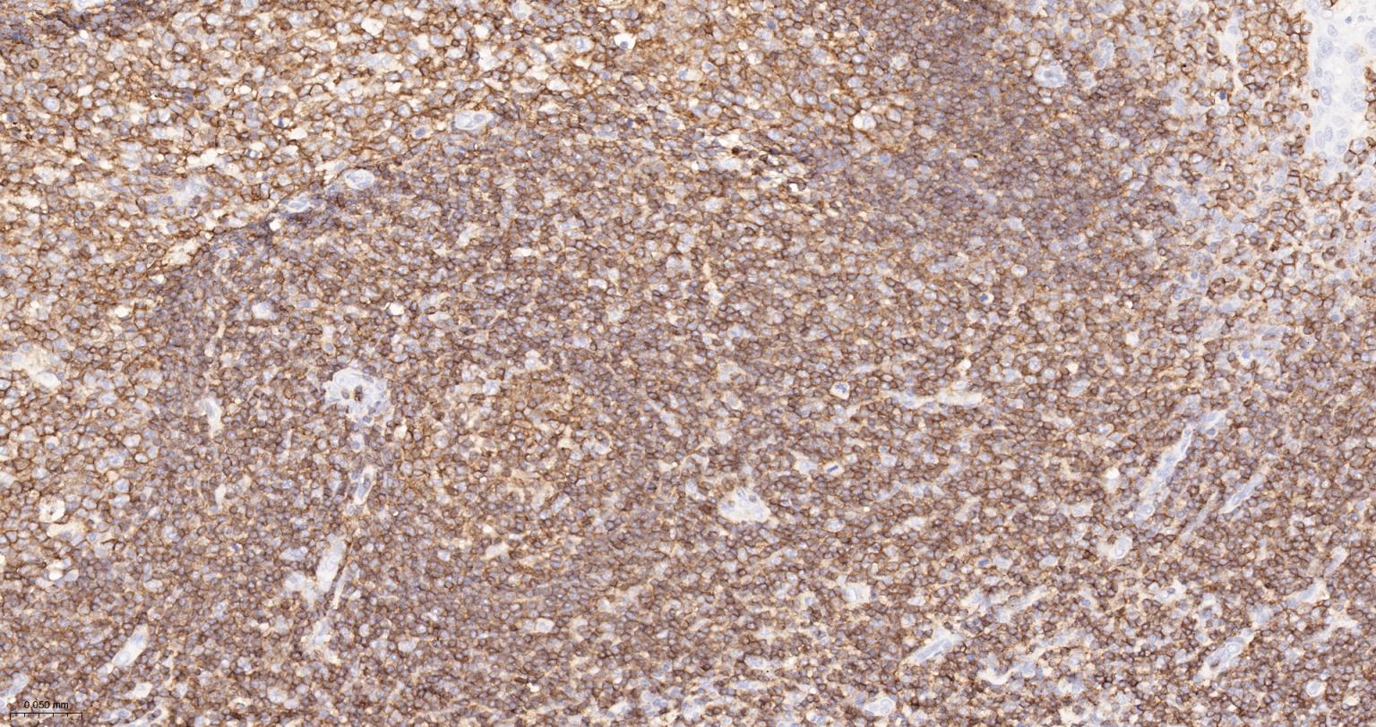 白细胞共同抗原CD45单克隆抗体-bsm-43704M