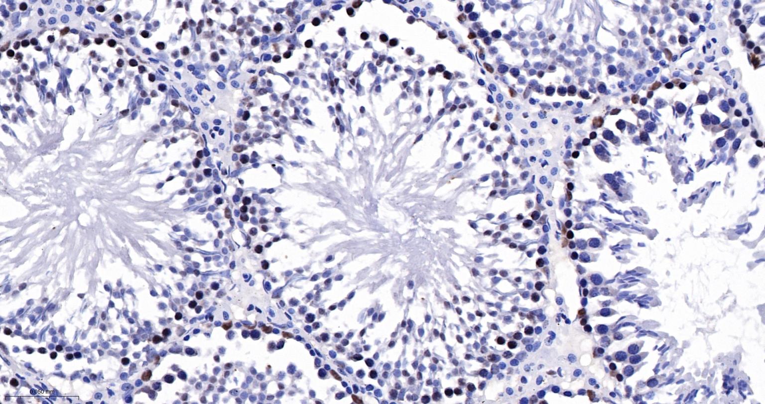 核仁蛋白NAP57重组兔单抗-bsm-61870R