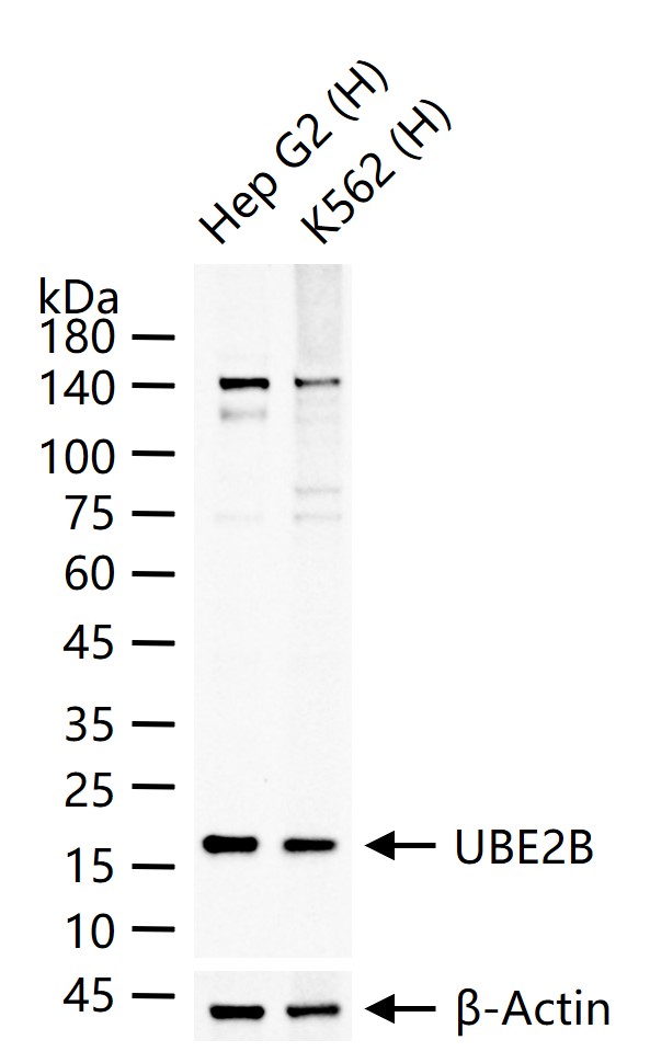 UBE2B Recombinant Rabbit mAb (一抗) - WB | Bioss