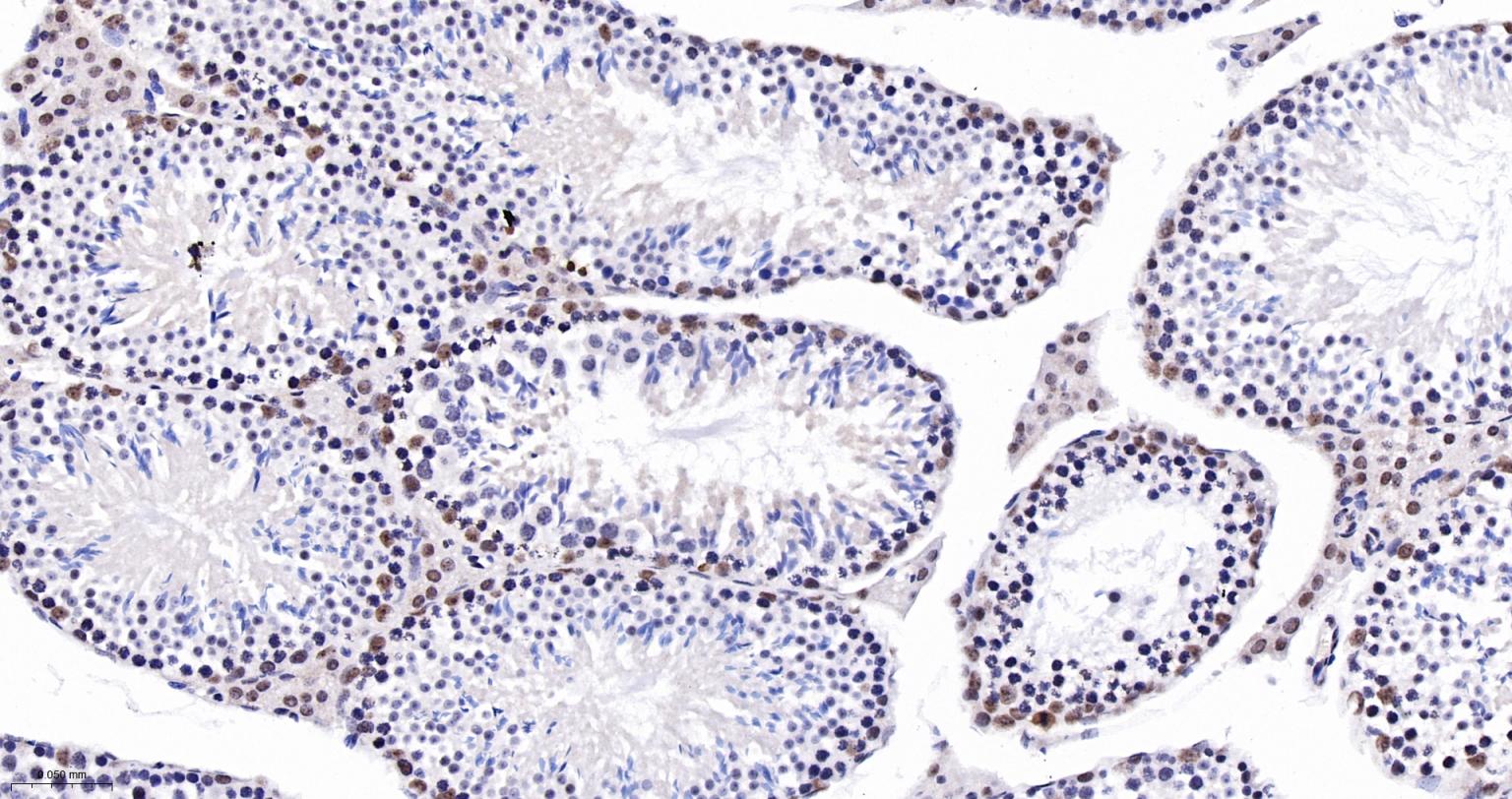 核仁蛋白NAP57重组兔单抗-bsm-61870R