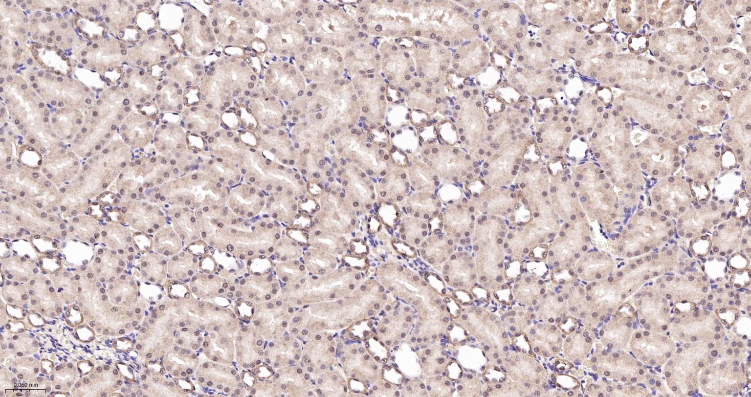 白细胞介素增强子结合因子2重组兔单抗