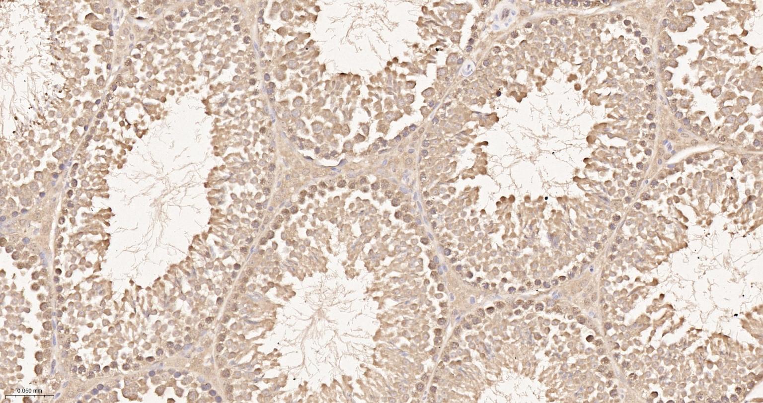 泛素蛋白重组兔单抗