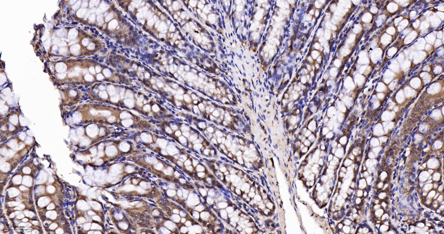白细胞介素增强子结合因子2重组兔单抗