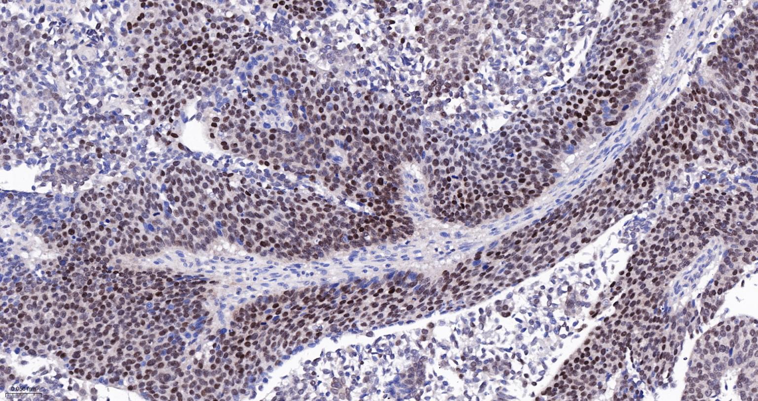 GATA结合蛋白3重组兔单克隆抗体