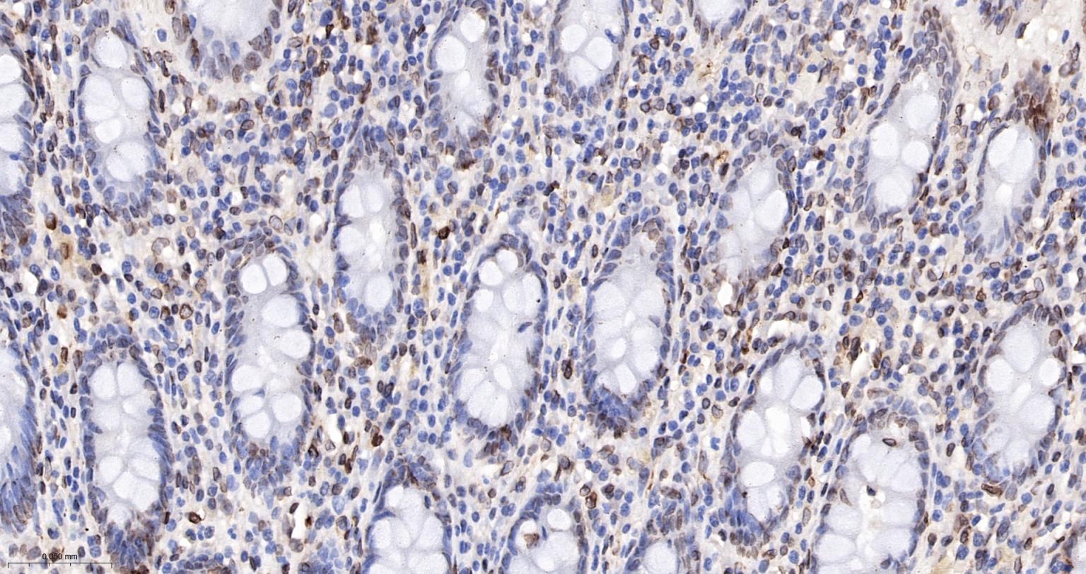 核纤层蛋白A重组兔单抗