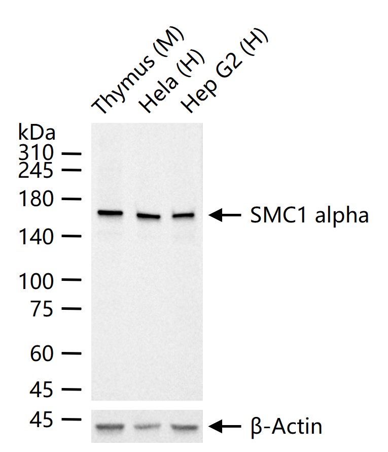 染色体结构维持蛋白质1α重组兔单抗