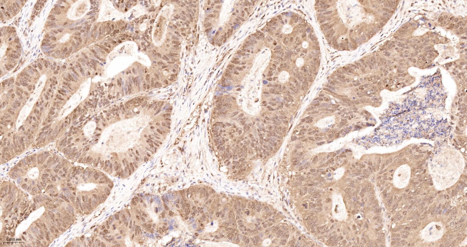 泛素蛋白重组兔单抗