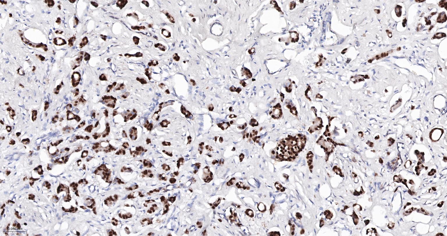GATA结合蛋白3重组兔单克隆抗体