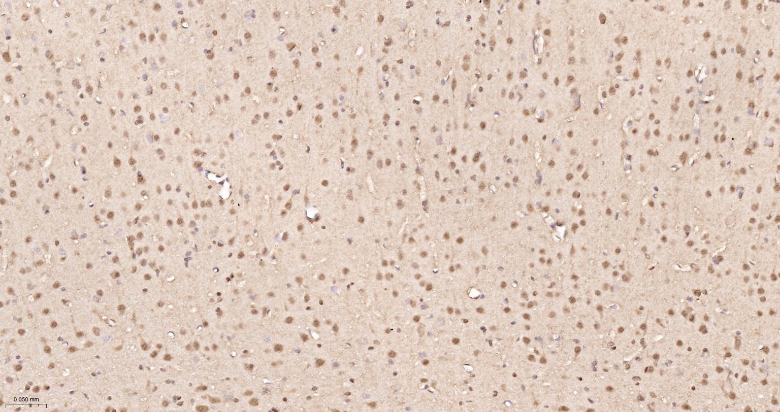 泛素蛋白重组兔单抗