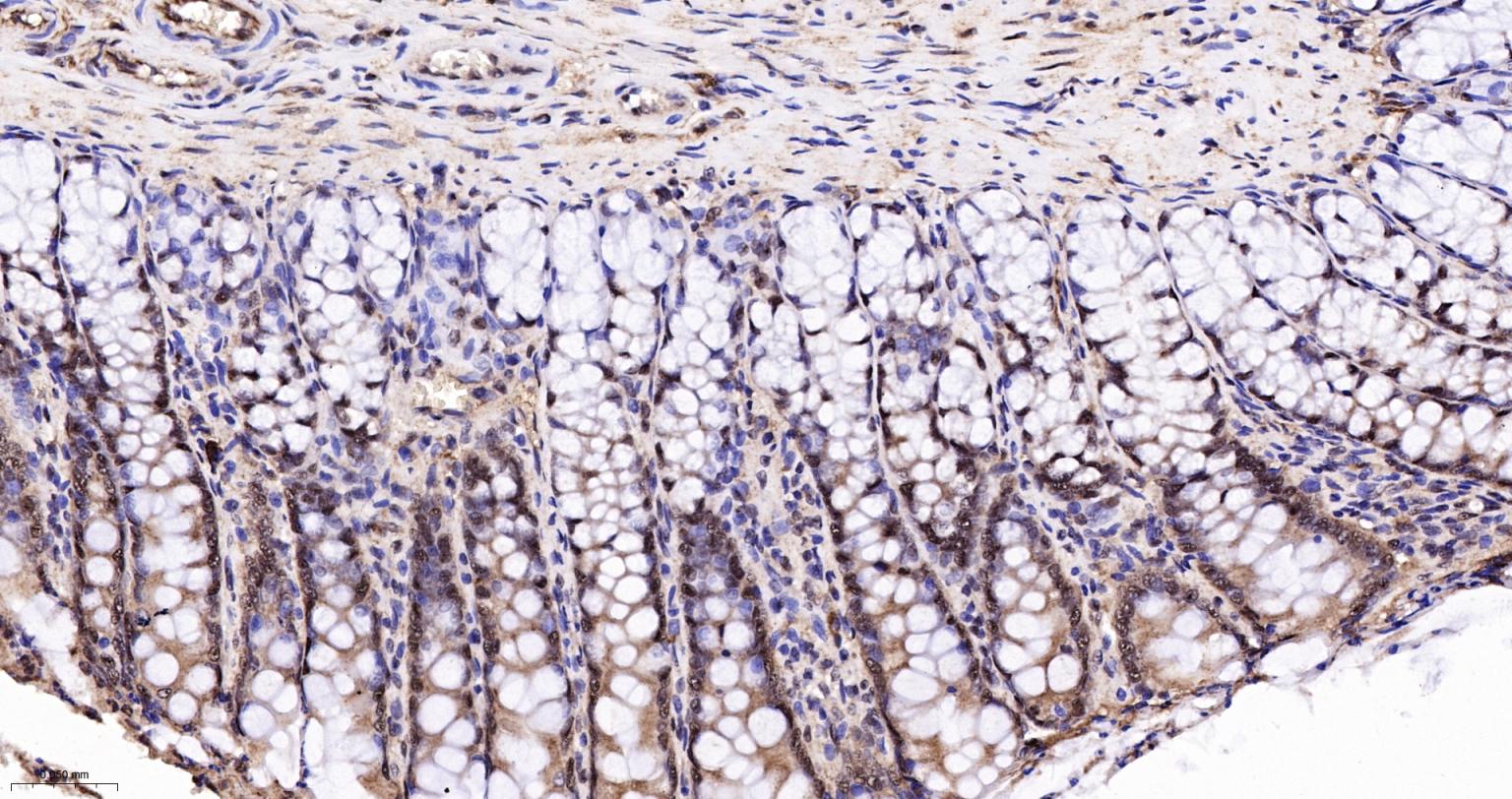 白细胞介素增强子结合因子2重组兔单抗
