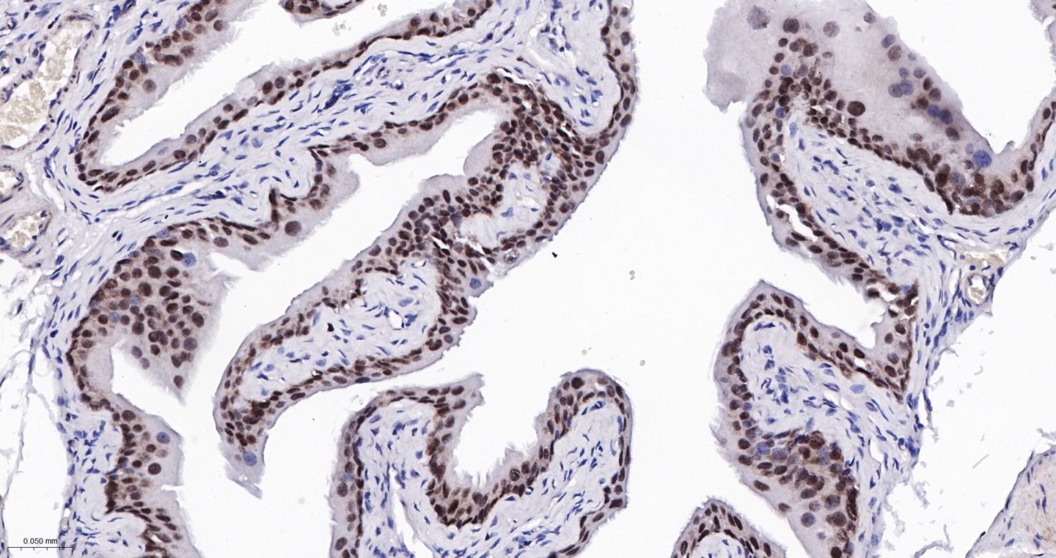 GATA结合蛋白3重组兔单克隆抗体