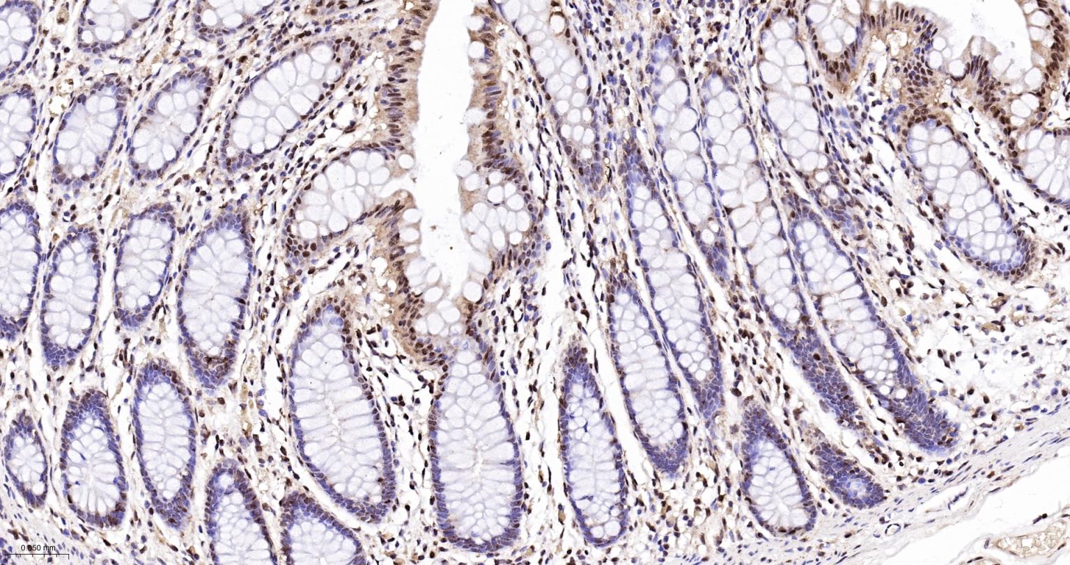 白细胞介素增强子结合因子2重组兔单抗