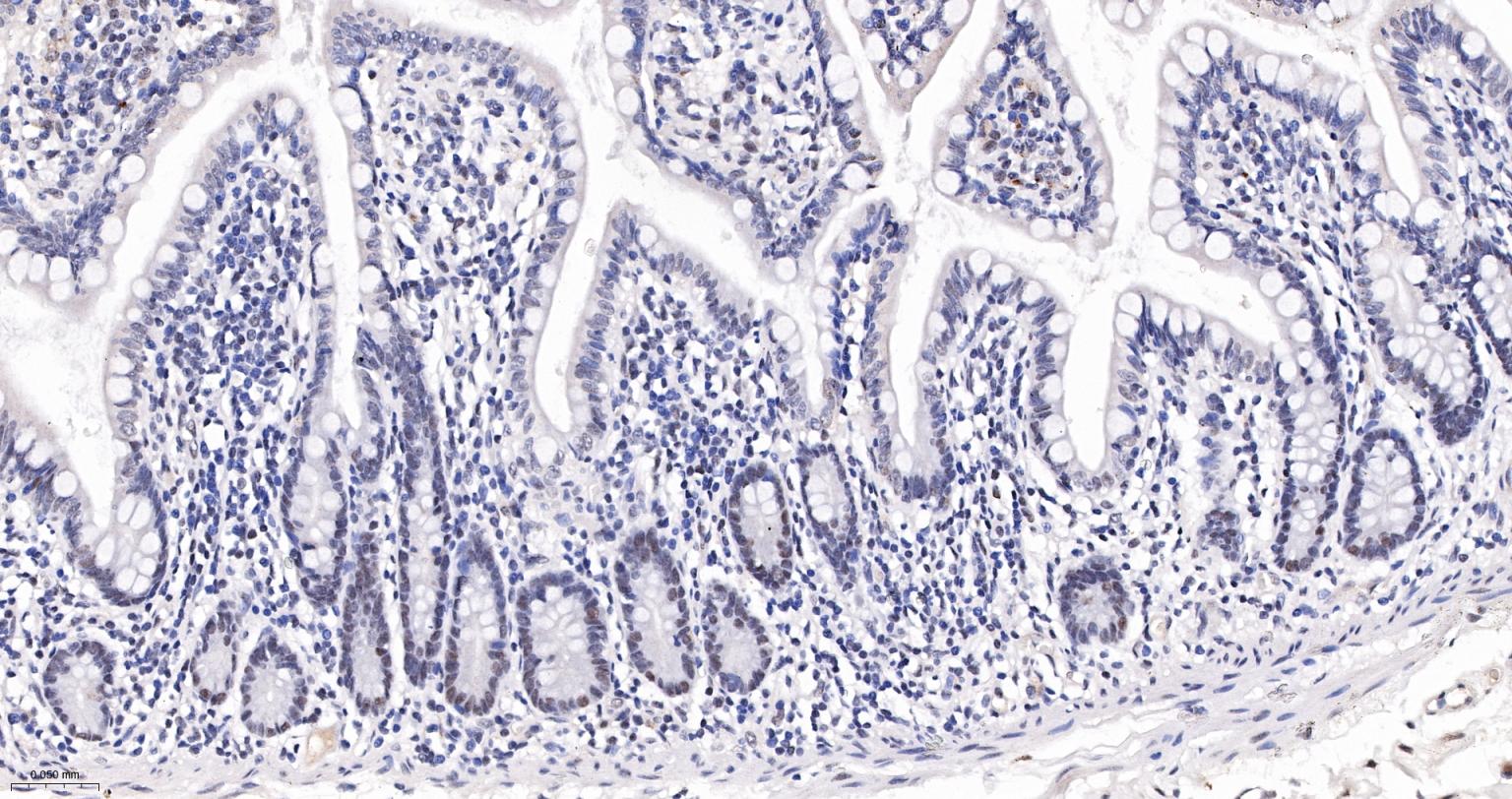 核仁蛋白NAP57重组兔单抗-bsm-61870R