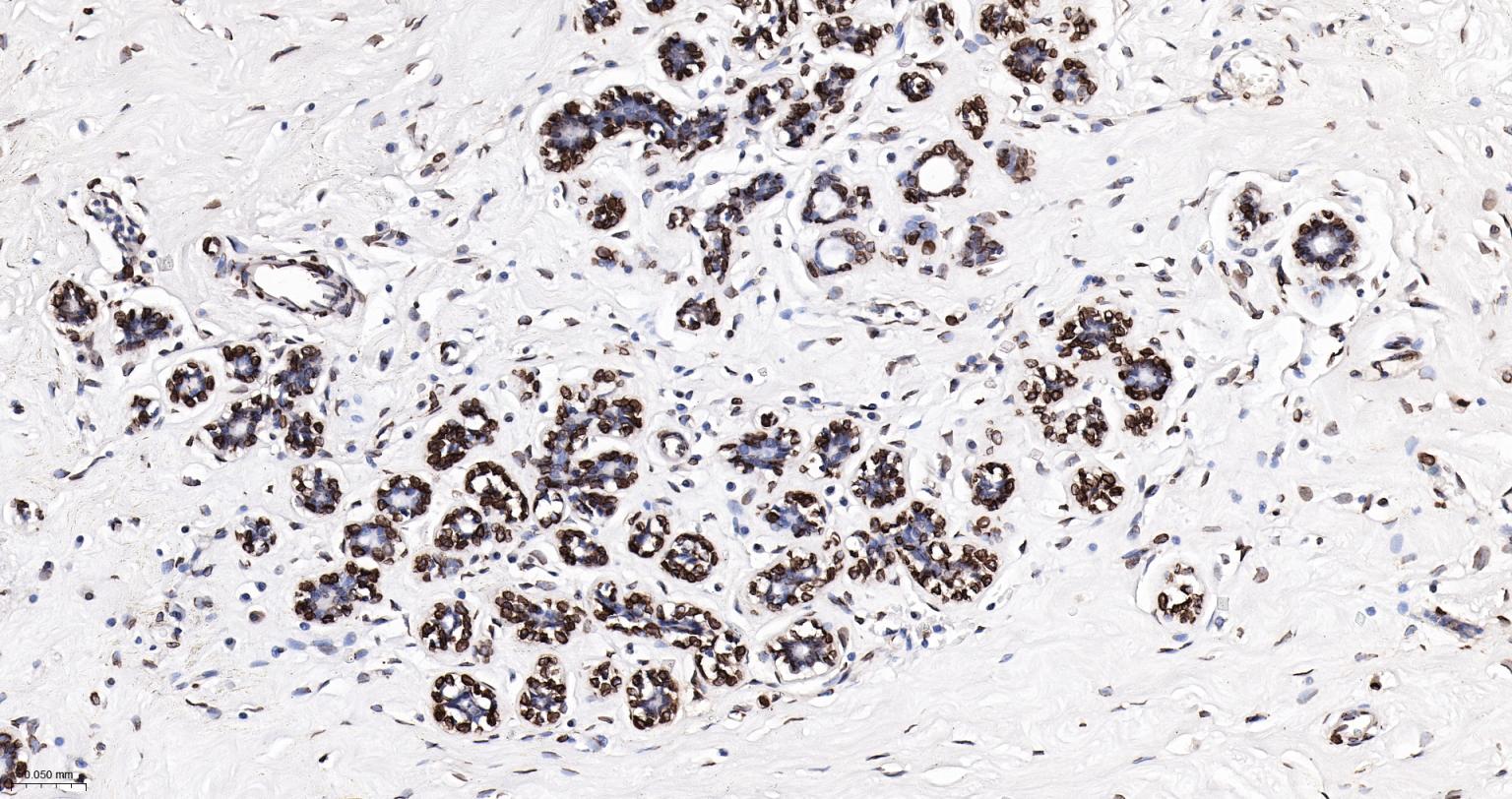 核纤层蛋白A重组兔单抗