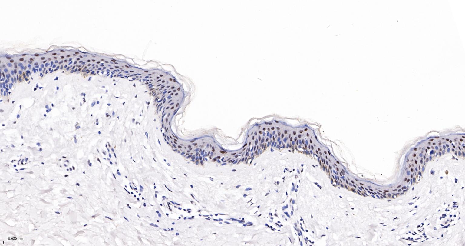核仁蛋白NAP57重组兔单抗-bsm-61870R