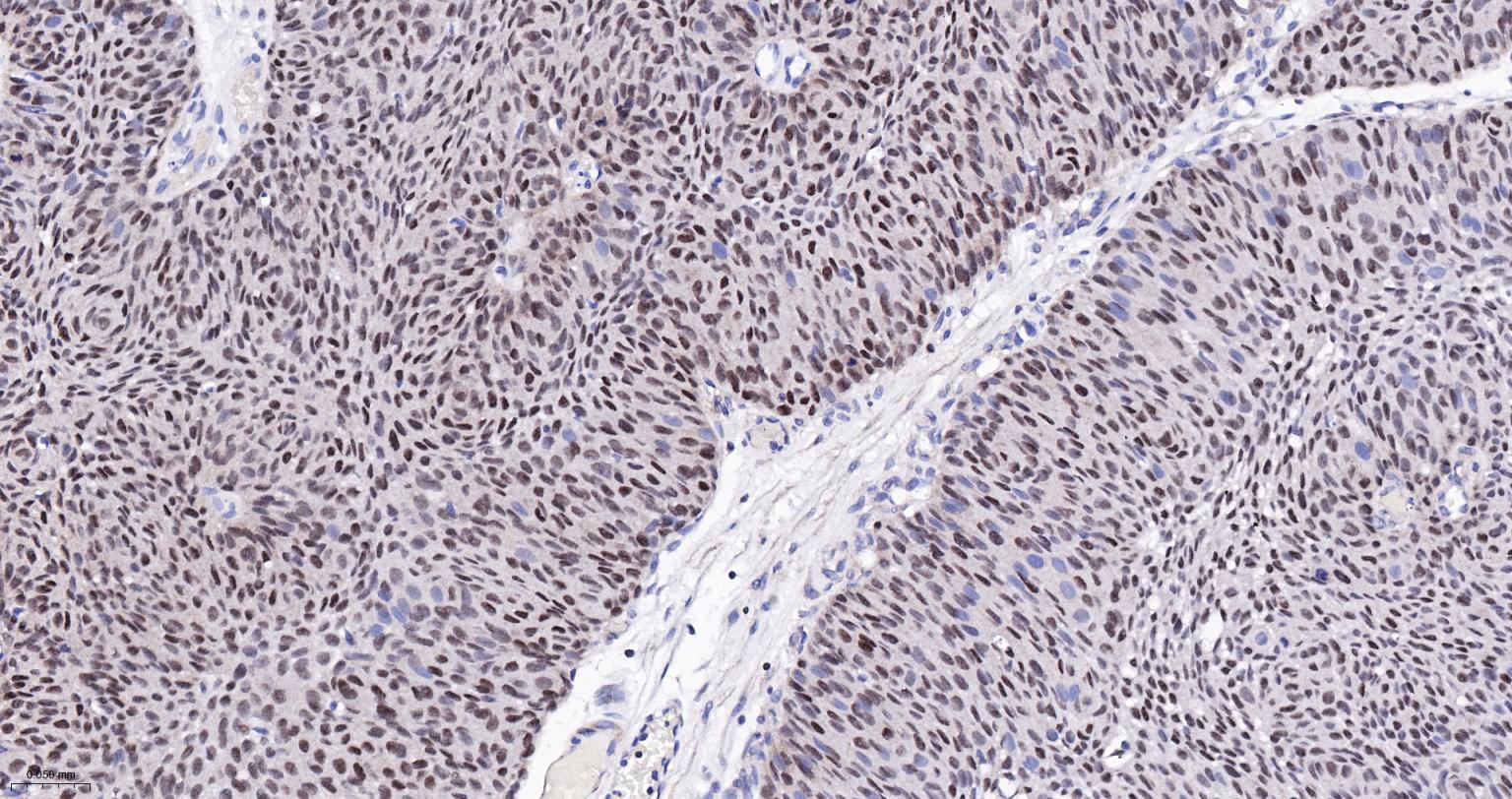GATA结合蛋白3重组兔单克隆抗体
