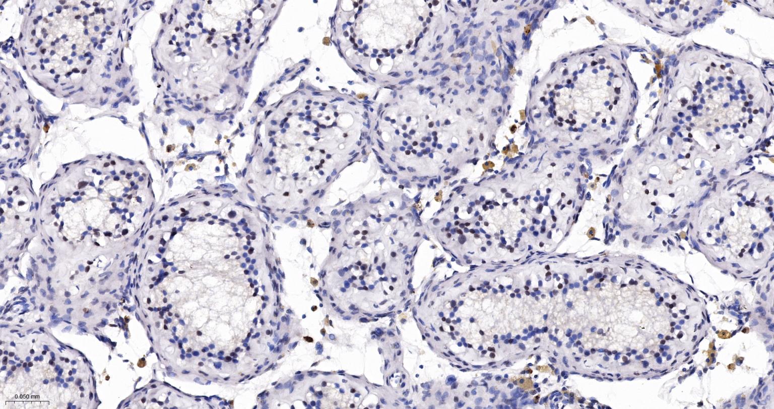 核仁蛋白NAP57重组兔单抗-bsm-61870R
