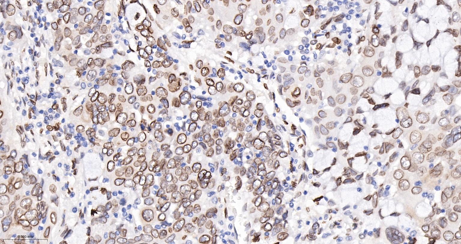 核纤层蛋白A重组兔单抗