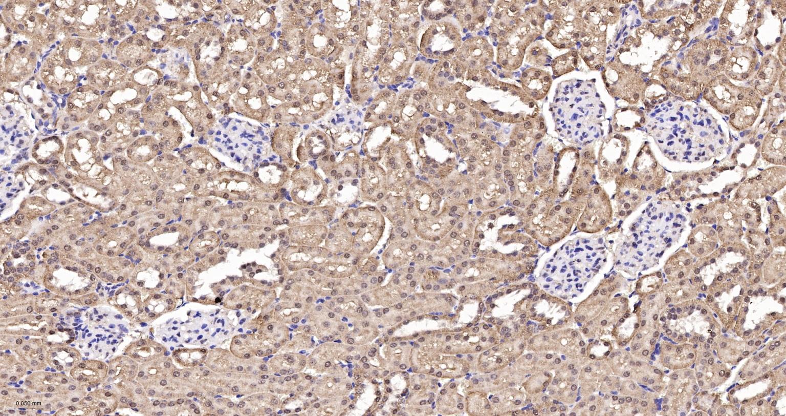 白细胞介素增强子结合因子2重组兔单抗