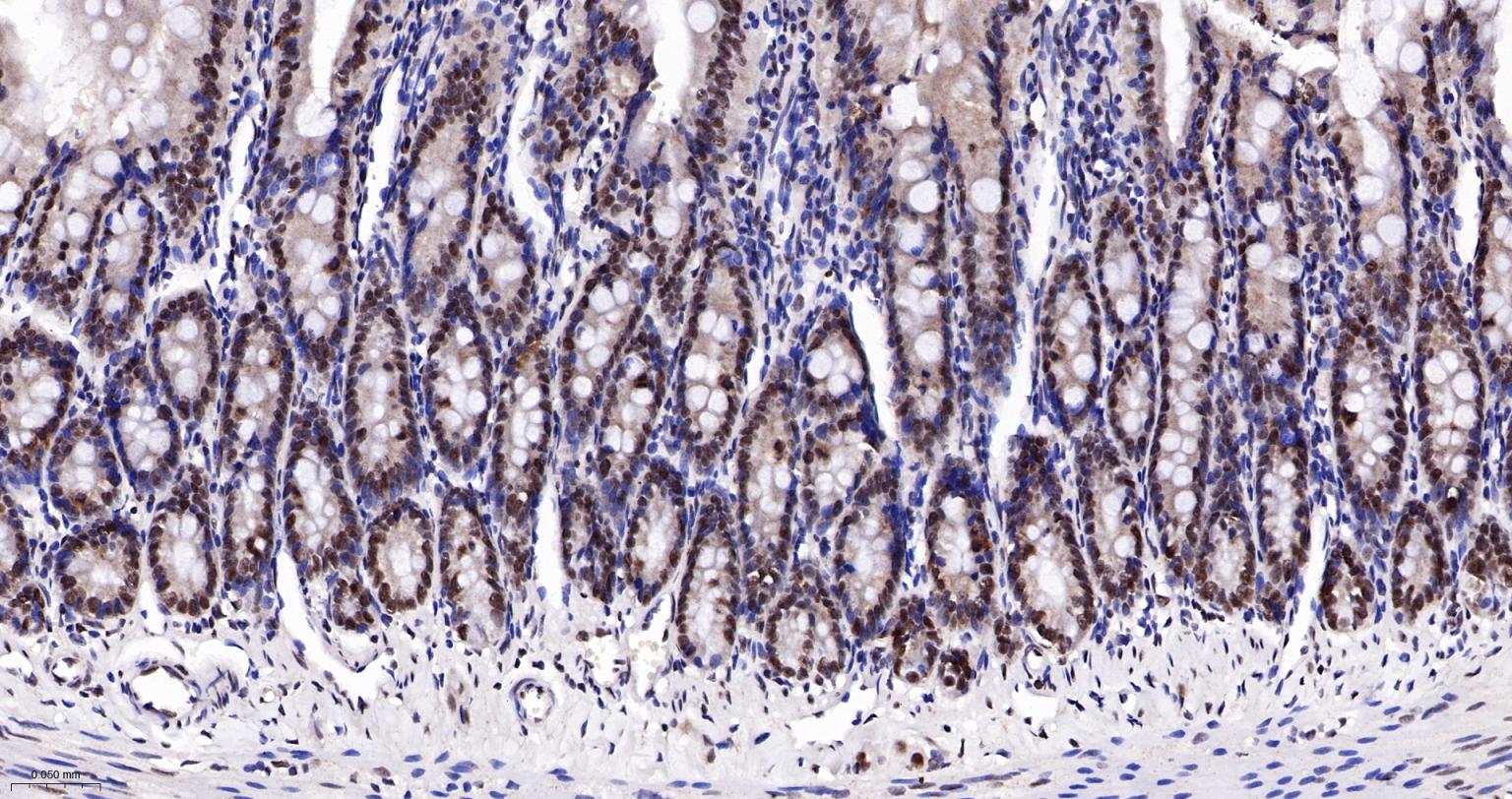 核仁蛋白NAP57重组兔单抗-bsm-61870R