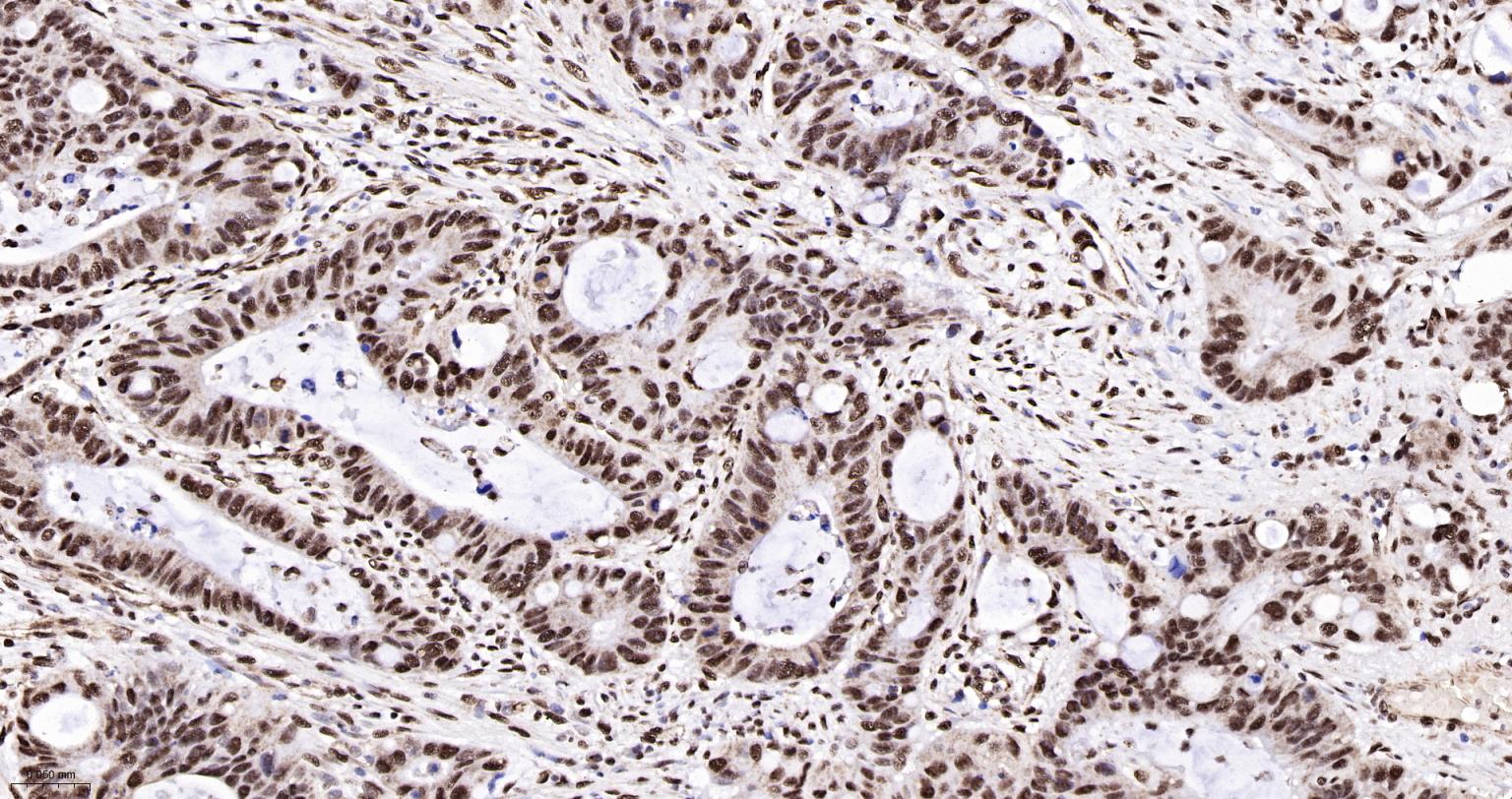 白细胞介素增强子结合因子2重组兔单抗