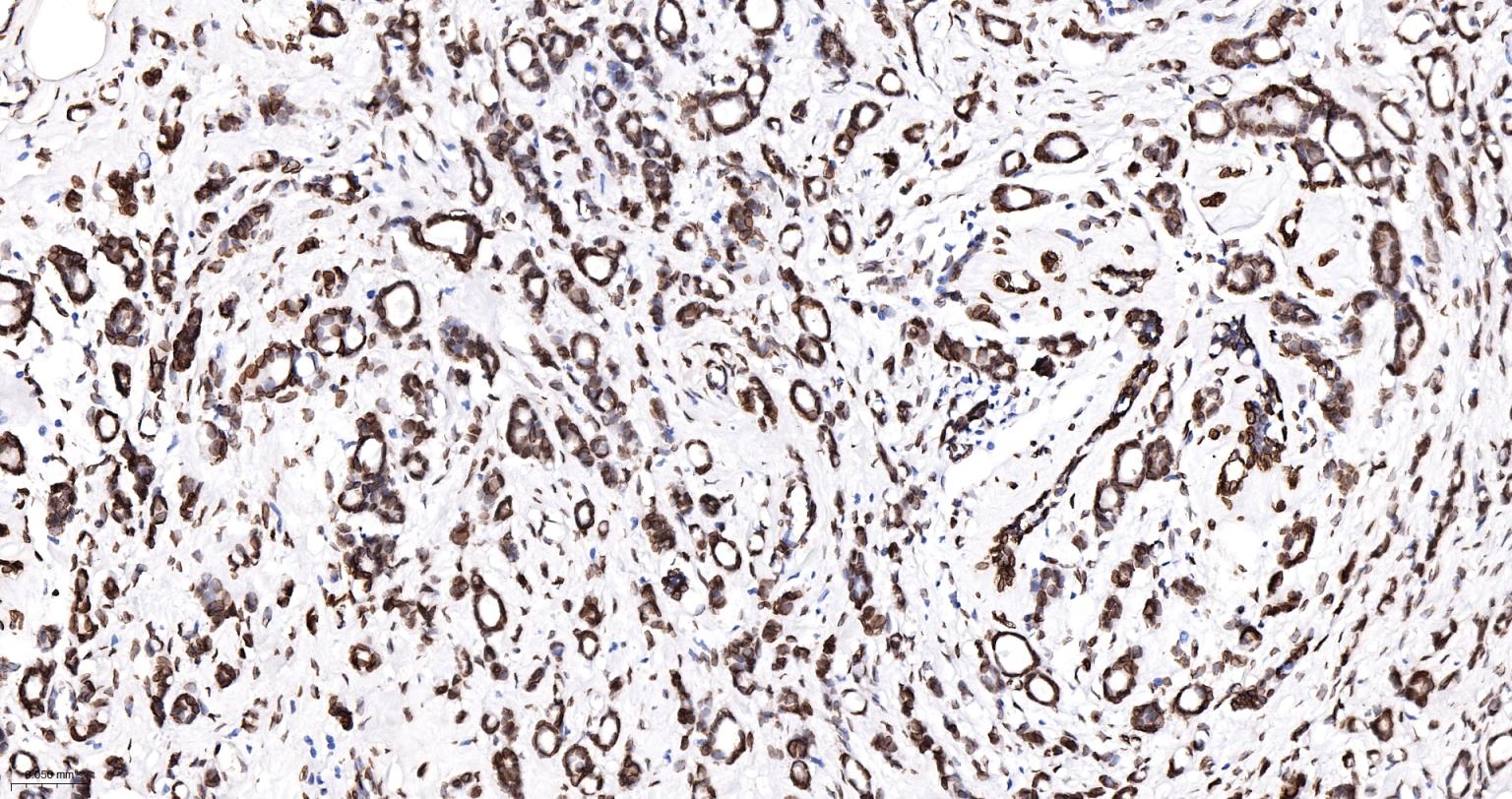 核纤层蛋白A重组兔单抗