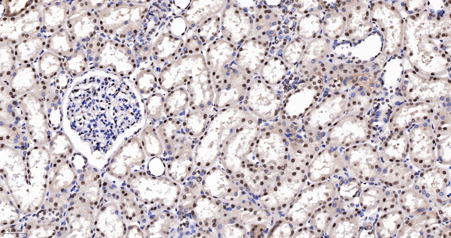 白细胞介素增强子结合因子2重组兔单抗