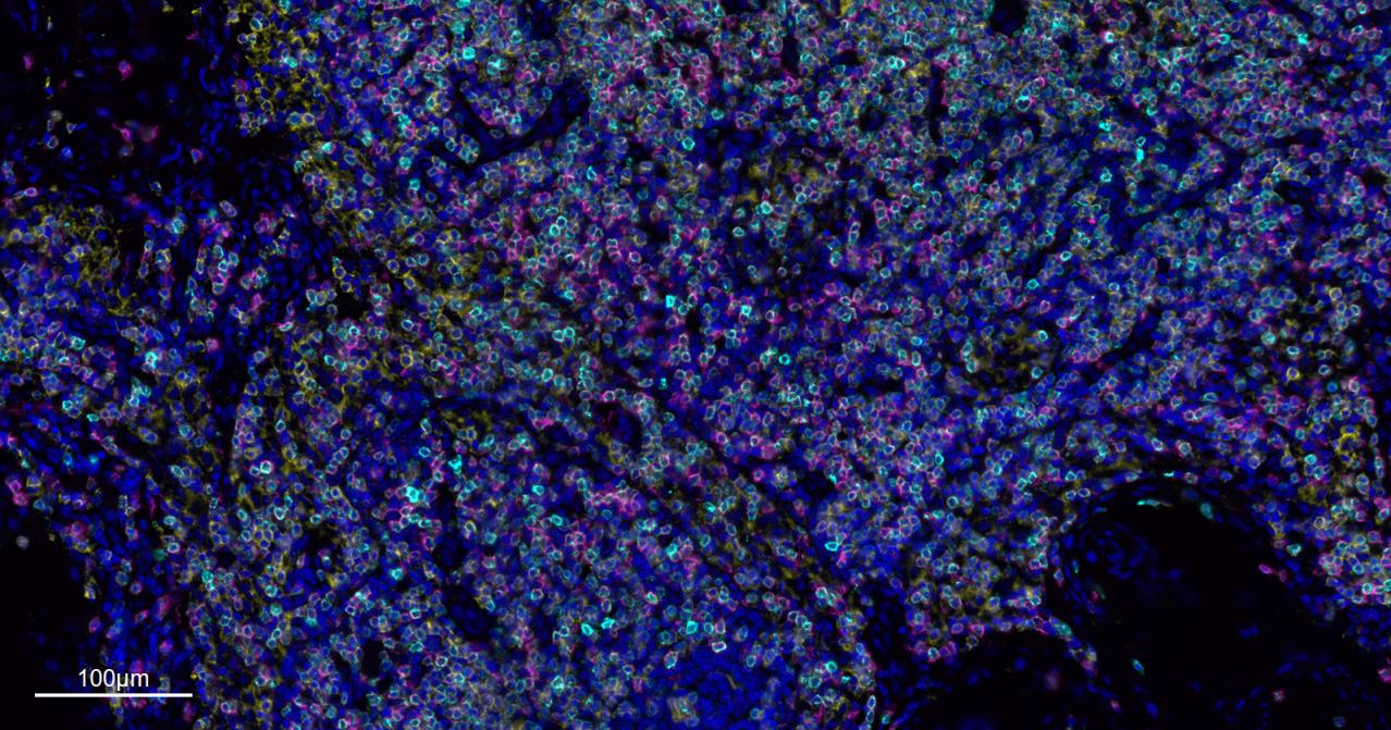 CD8A单克隆抗体-bsm-34251M