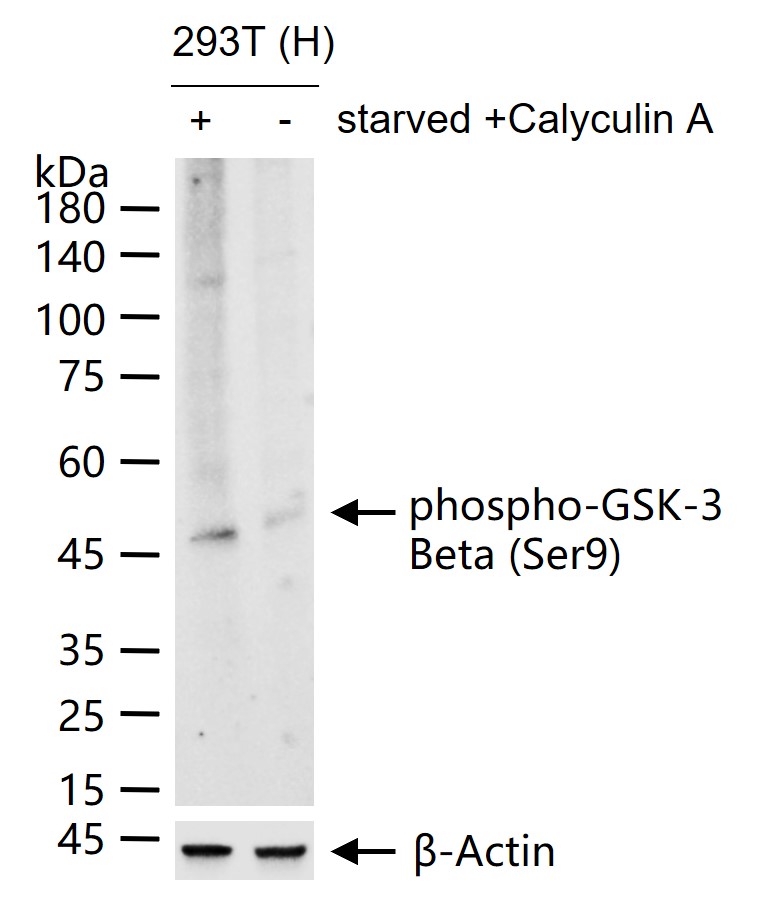 磷酸化糖原合酶激酶-3β重组兔单抗