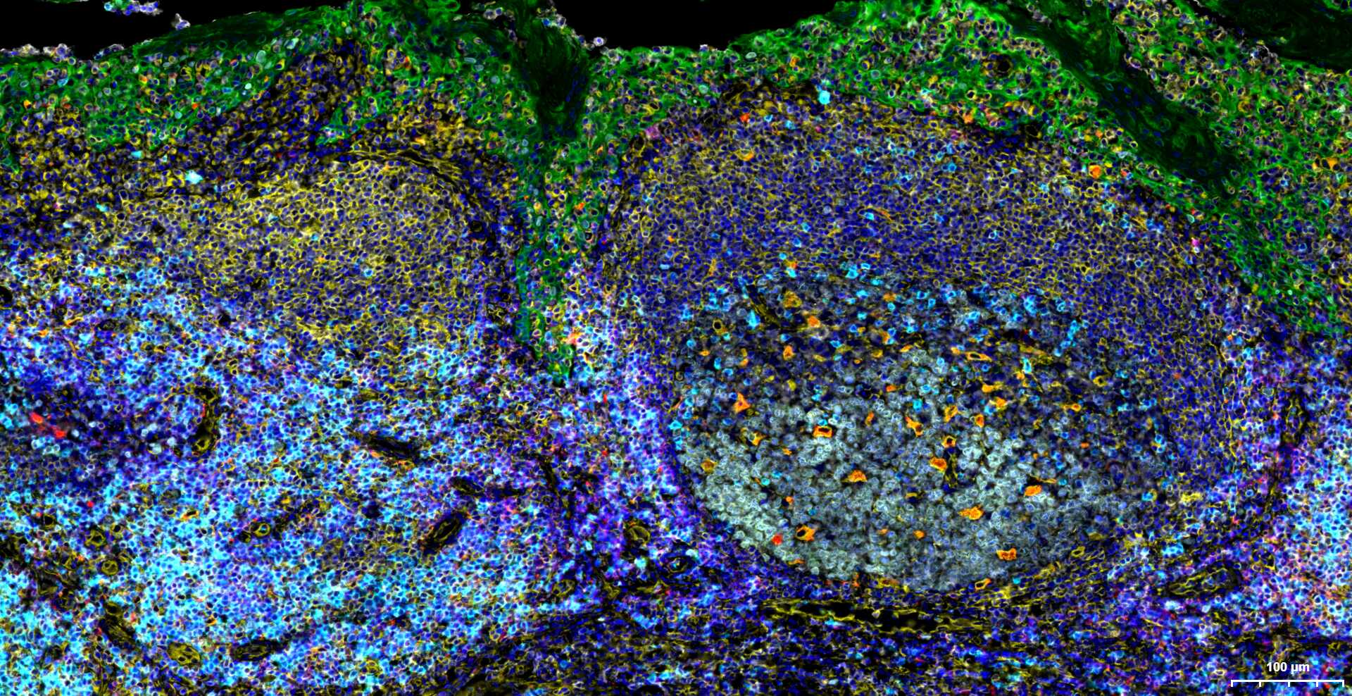 广谱细胞角蛋白PCK单克隆抗体