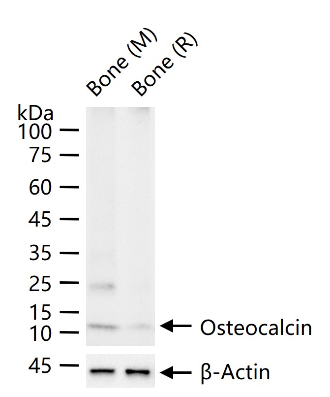 骨钙蛋白/骨钙素抗体-bs-4917R