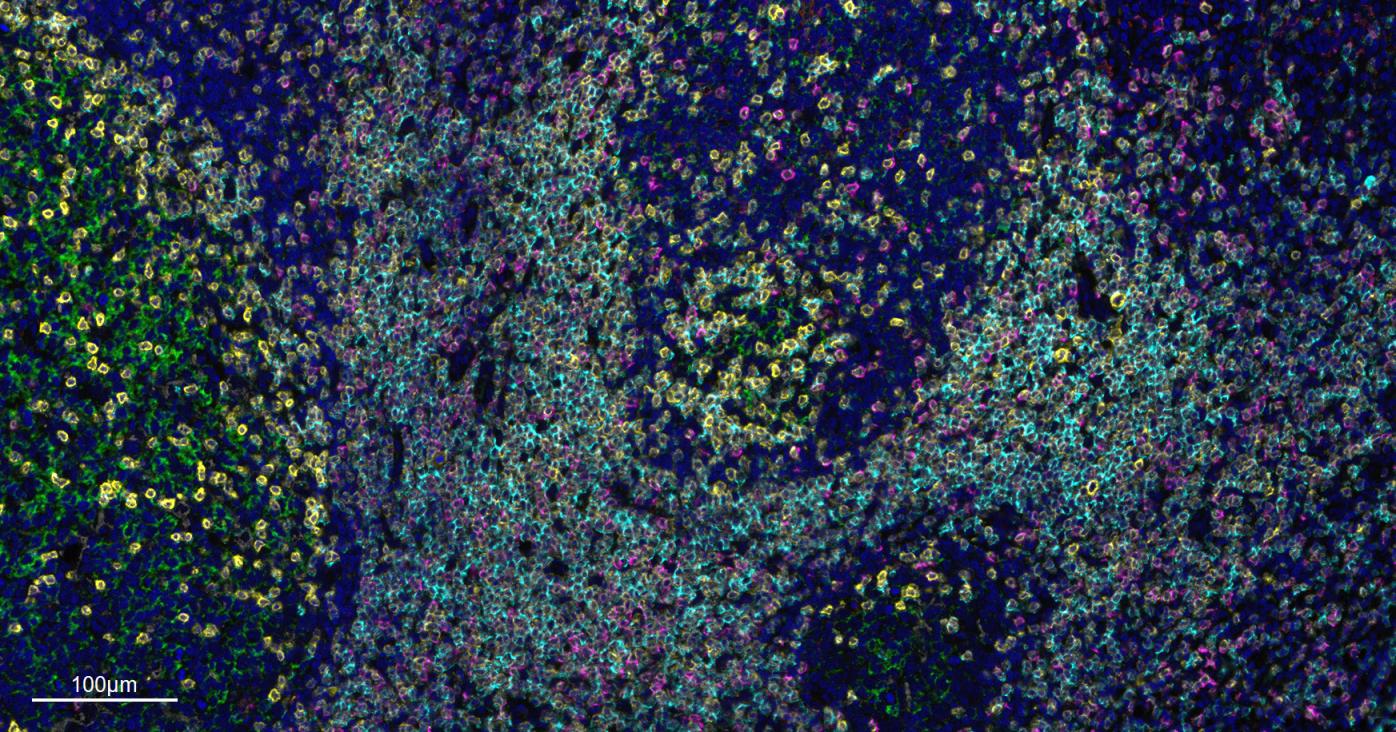 CD8A Mouse mAb (一抗) - IHC-P,IHC-F,IF | Bioss