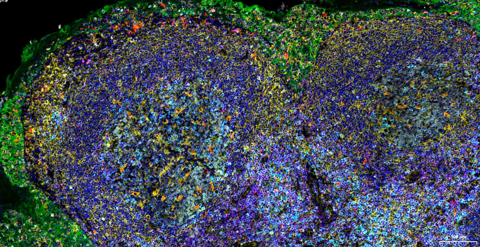 波形蛋白单克隆抗体-bsm-33170M