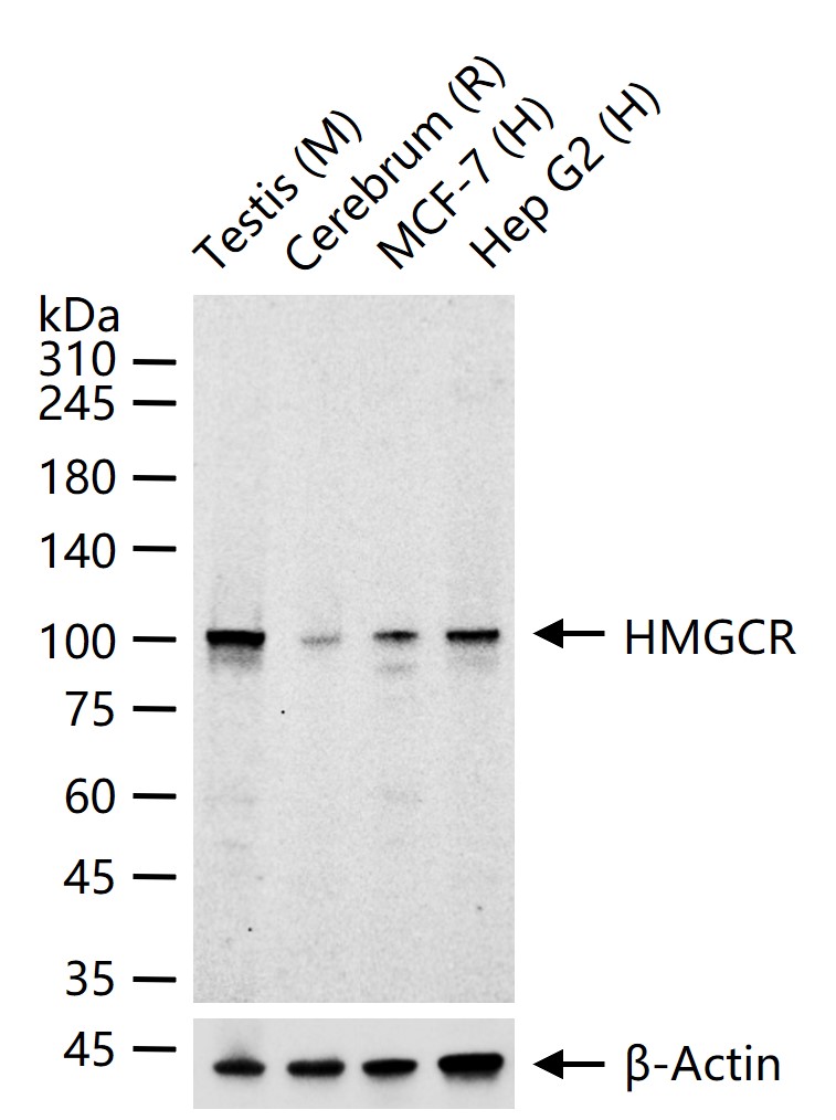 HMGCR重组兔单抗