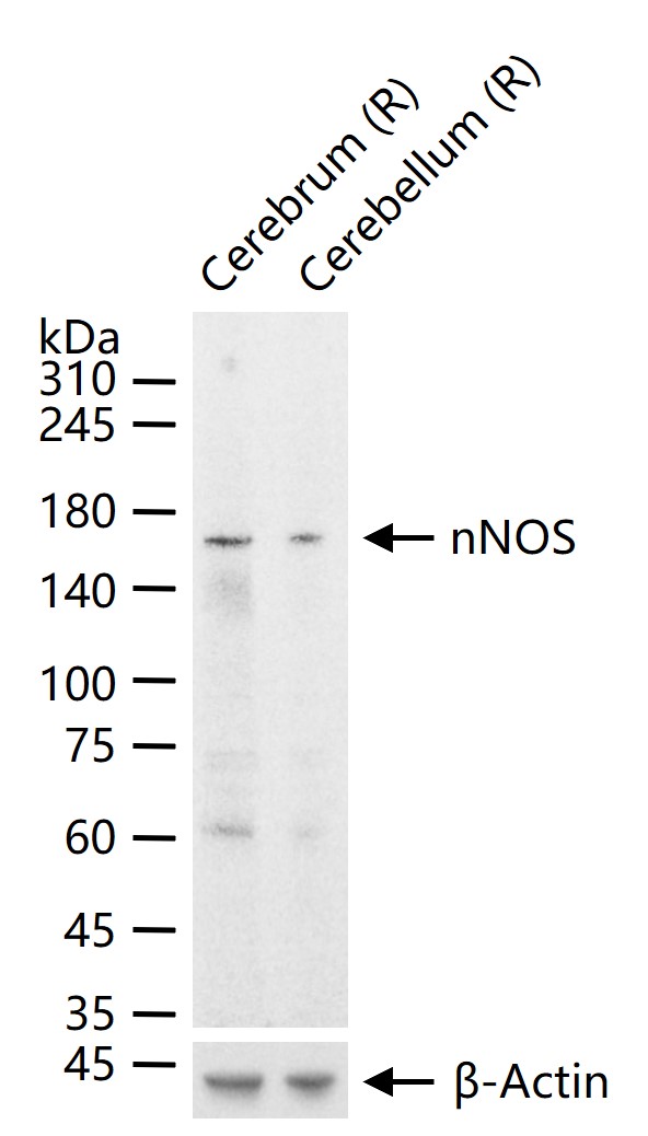 一氧化氮合成酶-1（神经型）重组兔单抗