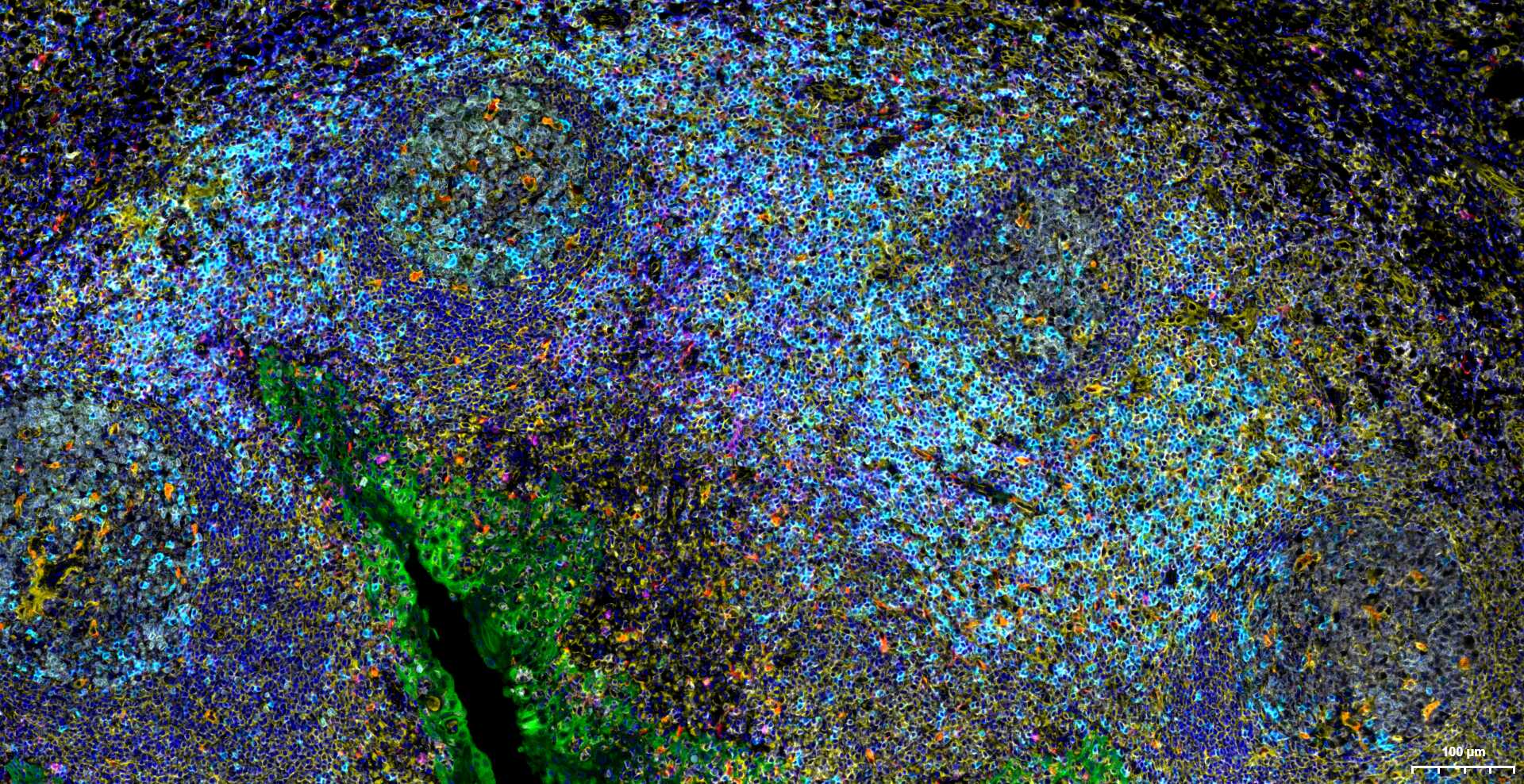 CD3/CD3-ε重组兔单抗