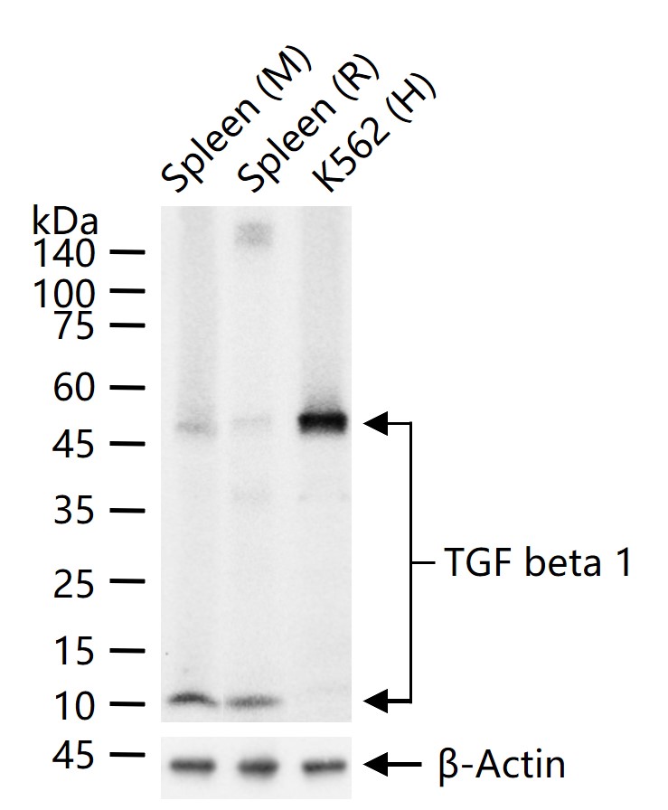 转化生长因子β1重组兔单抗