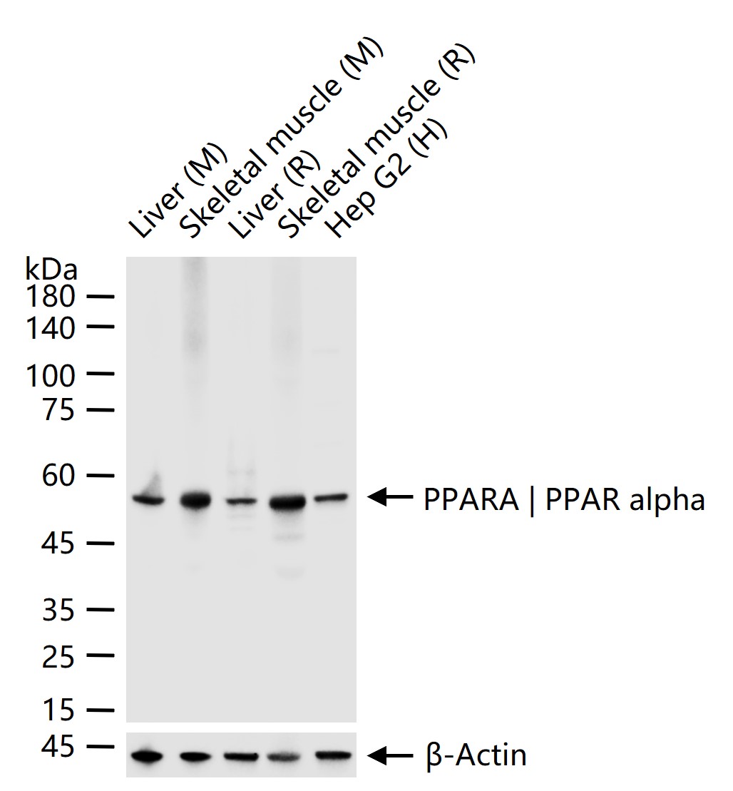 PPARA | PPAR alpha Recombinant Rabbit mAb (一抗) - WB | Bioss
