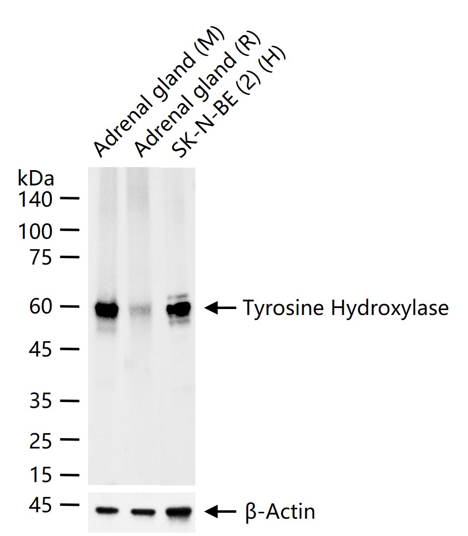 酪氨酸羟化酶兔单克隆抗体
