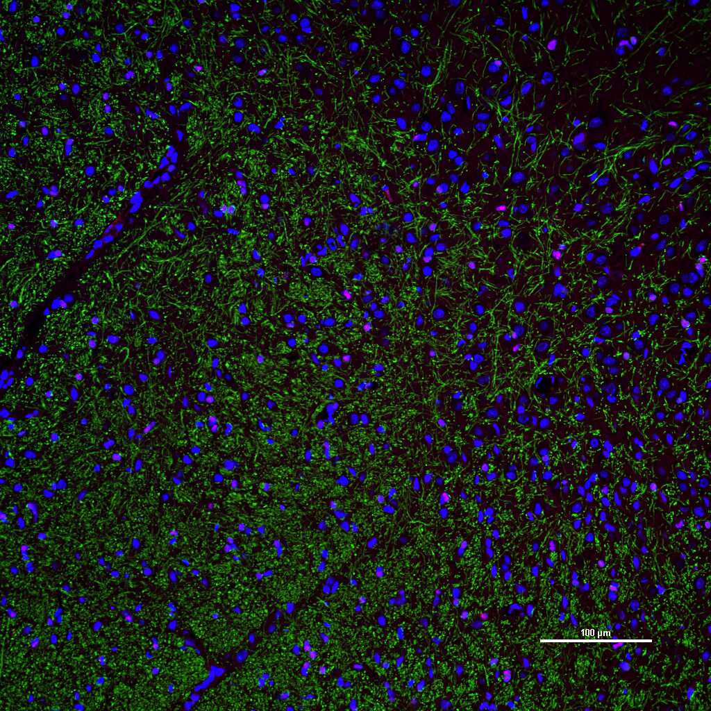 髓鞘碱性蛋白/磷脂碱性蛋白单克隆抗体-bsm-33932M