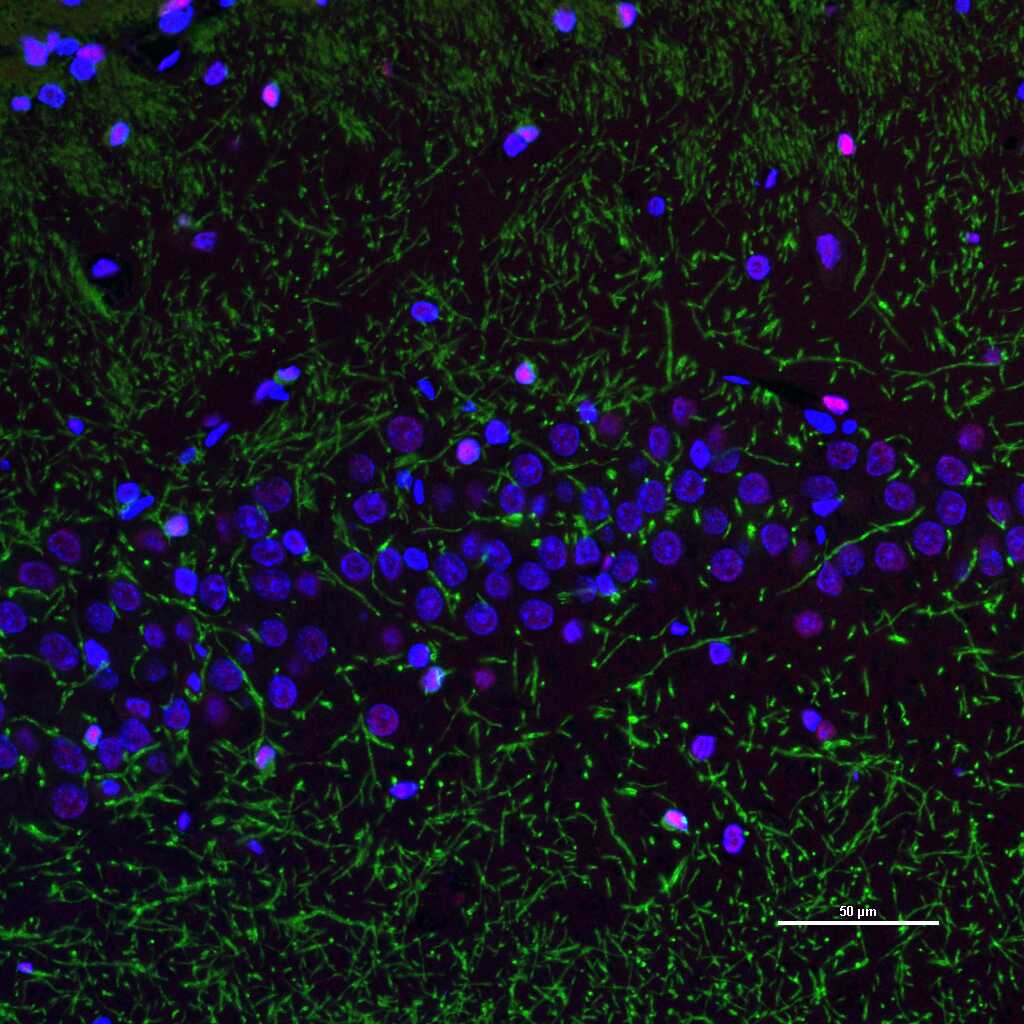 少突胶质细胞转录因子2重组兔单抗