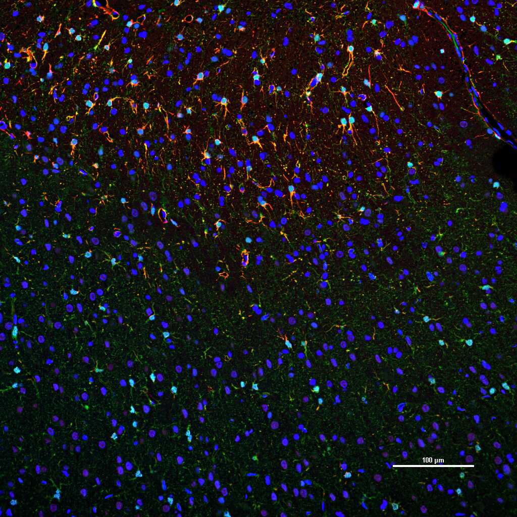 胶质纤维酸性蛋白重组兔单抗