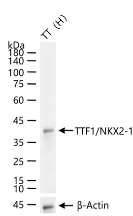 甲状腺核转录因子-1重组兔单抗