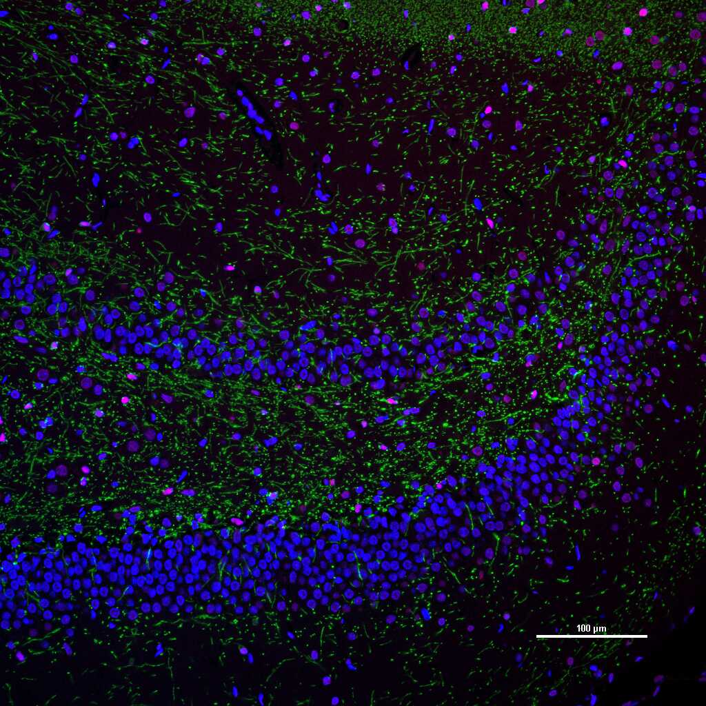 髓鞘碱性蛋白/磷脂碱性蛋白单克隆抗体-bsm-33932M