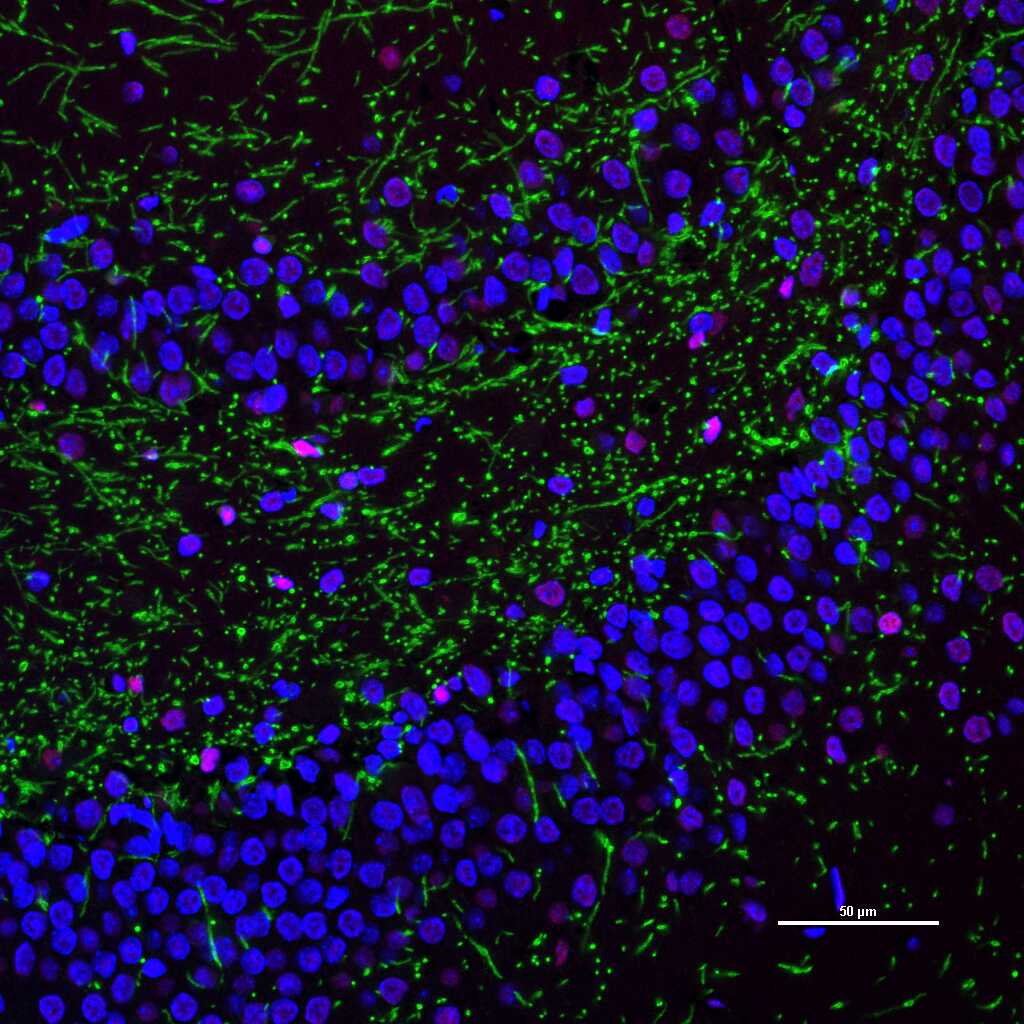 MBP Mouse mAb (一抗) - WB,IHC-P,IHC-F,IF | Bioss