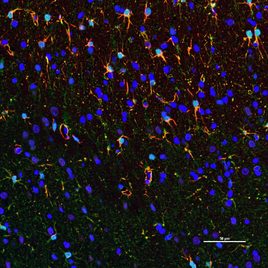 胶质纤维酸性蛋白重组兔单抗